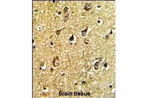 Formalin-fixed and paraffin-embedded human brain tissue with TH Antibody (C-term), which was peroxidase-conjugated to the secondary antibody, followed by DAB staining. (TH 抗体  (C-Term))