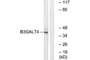 Western Blotting (WB) image for anti-UDP-Gal:betaGlcNAc beta 1,3-Galactosyltransferase, Polypeptide 4 (B3GALT4) (AA 181-230) antibody (ABIN2890160) (B3GALT4 抗体  (AA 181-230))