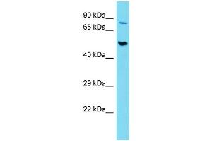 Host:  Rabbit  Target Name:  SLC44A2  Sample Type:  Thymus Tumor lysates  Antibody Dilution:  1. (SLC44A2 抗体  (Middle Region))