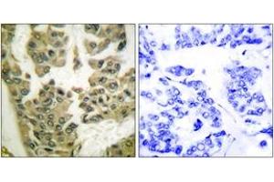 Immunohistochemistry (IHC) image for anti-Glucocorticoid Receptor DNA Binding Factor 1 (GRLF1) (AA 1071-1120), (pTyr1105) antibody (ABIN1531278)