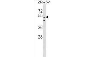 Western Blotting (WB) image for anti-PDZ Domain Containing 3 (PDZD3) antibody (ABIN2999605) (PDZD3 抗体)