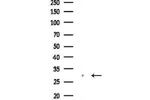 Western blot analysis of lysates from COLO205 cells(heat-shock,45 min treatment), using HLA-DQ Antibody at 1/1000 dilution.