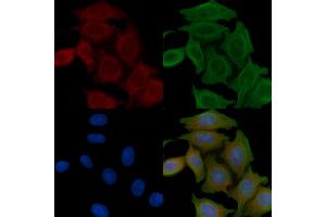 ABIN6258953 and ABIN6276209 staining Hela cells(45 min of heat-shock) by IF/ICC. (QRFPR 抗体  (Internal Region))
