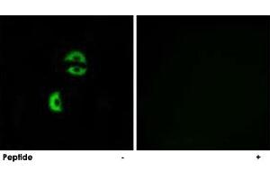 Immunofluorescence analysis of A-549 cells, using LDLRAD3 polyclonal antibody .