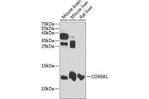 Western blot analysis of extracts of various cell lines, using COX6B1 antibody (ABIN6131579, ABIN6138917, ABIN6138918 and ABIN6216044) at 1:3000 dilution. (COX6B1 抗体  (AA 1-86))