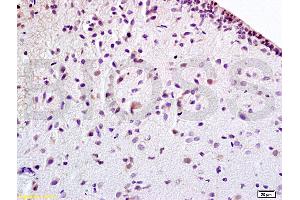 Formalin-fixed and paraffin embedded rat brain tissue labeled withAnti-EPOR Polyclonal Antibody (ABIN686347), Unconjugated at 1:100 followed by conjugation to the secondary antibody, (SP-0023), and DAB staining (EPOR 抗体  (AA 301-450))