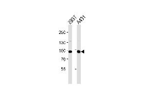Western blot analysis of lysates from 293T, A431 cell line (from left to right), using IL4R Antibody (C-term) (ABIN1944783 and ABIN2838524). (IL4 Receptor 抗体  (C-Term))