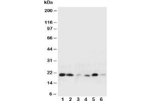 Western blot testing of HSPB2 antibody and Lane 1:  rat liver;  2: rat spleen;  3: human HeLa;  4: (h) COLO320;  5: (h) HT1080;  6: (h) MCF-7 cell lysate (HSPB2 抗体  (Middle Region))