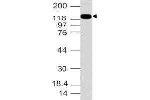 Image no. 1 for anti-Formin-Like 2 (FMNL2) (AA 1-321) antibody (ABIN5027206) (FMNL2 抗体  (AA 1-321))
