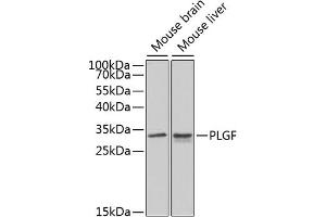Western blot analysis of extracts of various cell lines, using PLGF antibody (ABIN3015554, ABIN3015555, ABIN3015556 and ABIN6218826) at 1:1000 dilution. (PLGF 抗体  (AA 19-170))