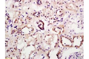 Formalin-fixed and paraffin embedded human kidney labeled with Anti-A4GALT Polyclonal Antibody, Unconjugated (ABIN873268) at 1:200 followed by conjugation to the secondary antibody and DAB staining (A4GALT 抗体  (AA 291-353))