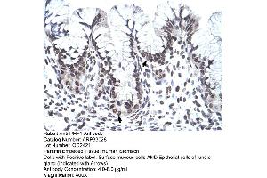 Human Stomach (PHF1 抗体  (C-Term))