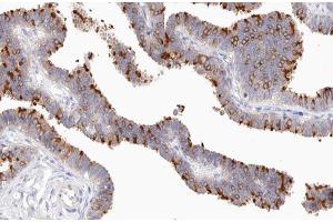 ABIN6267583 at 1/200 staining human Fallopian tube tissue sections by IHC-P. (NFKB2 抗体  (pSer870))