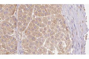ABIN6273781 at 1/100 staining Human Melanoma tissue by IHC-P. (FGF19 抗体  (C-Term))