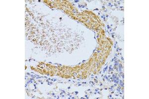 Immunohistochemistry of paraffin-embedded mouse lung using CYCS antibody.
