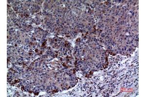 Immunohistochemistry (IHC) analysis of paraffin-embedded Human Lung, antibody was diluted at 1:100. (Periaxin 抗体  (Internal Region))