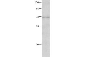 Western Blot analysis of Human fetal lung tissue using IGF2BP1 Polyclonal Antibody at dilution of 1:500 (IGF2BP1 抗体)