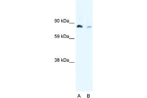 WB Suggested Anti-NFKB2 Antibody Titration:  0. (NFKB2 抗体  (N-Term))