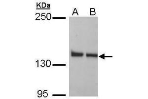 WB Image Sample (30 ug of whole cell lysate) A: H1299 B: HeLa 5% SDS PAGE antibody diluted at 1:1000 (LRPPRC 抗体)