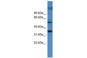 Western Blotting (WB) image for anti-Cytochrome P450, Family 11, Subfamily B, Polypeptide 1 (CYP11B1) (Middle Region) antibody (ABIN2788350)