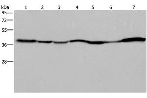 Western Blot analysis of 293T and Hela cell, Human fetal liver, Mouse spleen and heart tissue, Human fetal brain and hepatocellular carcinoma tissue using GOT2 Polyclonal Antibody at dilution of 1:400 (GOT2 抗体)