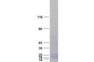 Western Blotting (WB) image for Lymphocyte Antigen 96 (LY96) (Transcript Variant 2) protein (Myc-DYKDDDDK Tag) (ABIN2725665)