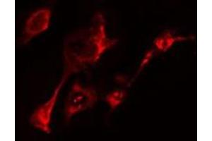 ABIN6275460 staining  HeLa cells by IF/ICC. (RAB20 抗体  (Internal Region))