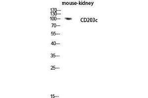 Western Blot (WB) analysis of Mouse Kidney lysis using CD203c antibody. (ENPP3 抗体  (Internal Region))