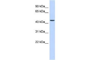 WB Suggested Anti-OGDH Antibody Titration: 0. (alpha KGDHC 抗体  (N-Term))