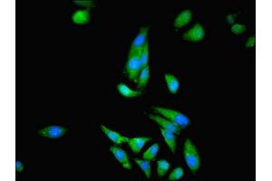 Immunofluorescent analysis of Hela cells using ABIN7148658 at dilution of 1:100 and Alexa Fluor 488-congugated AffiniPure Goat Anti-Rabbit IgG(H+L) (CKB 抗体  (AA 2-270))