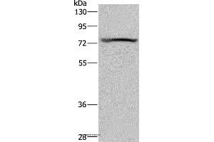 Western blot analysis of Mouse heart tissue, using KCNQ1 Polyclonal Antibody at dilution of 1:200 (KCNQ1 抗体)