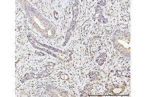IHC analysis of MOV10 using anti-MOV10 antibody (ABIN7600236). (MOV10 抗体  (AA 167-772))
