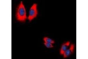 Immunofluorescent analysis of Caspase 9 p35 staining in HeLa cells. (Caspase 9 p35 抗体)