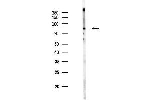 anti-Tumor Necrosis Factor, alpha-Induced Protein 3 (TNFAIP3) (Internal Region) antibody