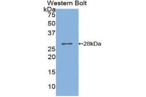 Western Blotting (WB) image for anti-Phospholipase A2, Group VI (Cytosolic, Calcium-Independent) (PLA2G6) (AA 481-702) antibody (ABIN1859465) (PLA2G6 抗体  (AA 481-702))