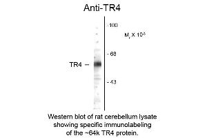 Western Blotting (WB) image for anti-Nuclear Receptor Subfamily 2, Group C, Member 2 (NR2C2) (N-Term) antibody (ABIN6657690)