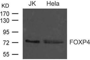Western blot analysis of extract from JK and Hela cells using FOXP4 Antibody (FOXP4 抗体)