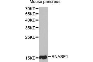 Western Blotting (WB) image for anti-Ribonuclease, RNase A Family, 1 (Pancreatic) (RNASE1) antibody (ABIN1882329) (RNASE1 抗体)