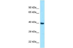 WB Suggested Anti-MC1R Antibody Titration: 1. (MC1 Receptor 抗体  (C-Term))