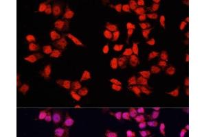 Immunofluorescence analysis of HeLa cells using YBX1 Polyclonal Antibody at dilution of 1:100. (YBX1 抗体)