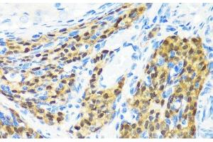Immunohistochemistry of paraffin-embedded Rat ovary using KMT2E Polyclonal Antibody at dilution of 1:200 (40x lens). (MLL5/KMT2E 抗体)