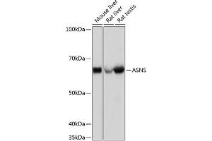 Western blot analysis of extracts of various cell lines, using ASNS Rabbit mAb (ABIN7265692) at 1:1000 dilution. (Asparagine Synthetase 抗体)