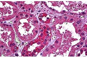 Human Kidney: Formalin-Fixed, Paraffin-Embedded (FFPE) (ERBB3 抗体  (AA 1-131))