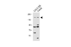 All lanes : Anti-TNIK Antibody at 1:1000 dilution Lane 1: COLO 205 whole cell lysate Lane 2:Caco2 whole cell lysate Lysates/proteins at 20 μg per lane. (TNIK 抗体  (Ser764))