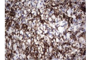 Immunohistochemistry (IHC) image for anti-Keratin Acidic (AE1) antibody (ABIN2715666)