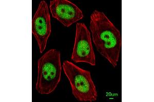 Immunofluorescent analysis of  cells, using KLF4 Antibody f. (KLF4 抗体  (AA 481-504))