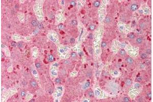 Human Liver (formalin-fixed, paraffin-embedded) stained with A2M antibody ABIN291670 at 2. (alpha 2 Macroglobulin 抗体)