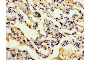 Immunohistochemistry of paraffin-embedded human lung tissue using ABIN7150056 at dilution of 1:100 (ADAM33 抗体  (AA 140-420))