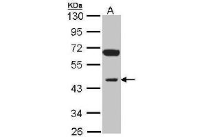 WB Image Sample (30 ug of whole cell lysate) A: Raji 10% SDS PAGE antibody diluted at 1:1000 (INPP1 抗体)