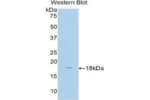 Western blot analysis of the recombinant protein. (Hexokinase 1 抗体  (AA 137-270))